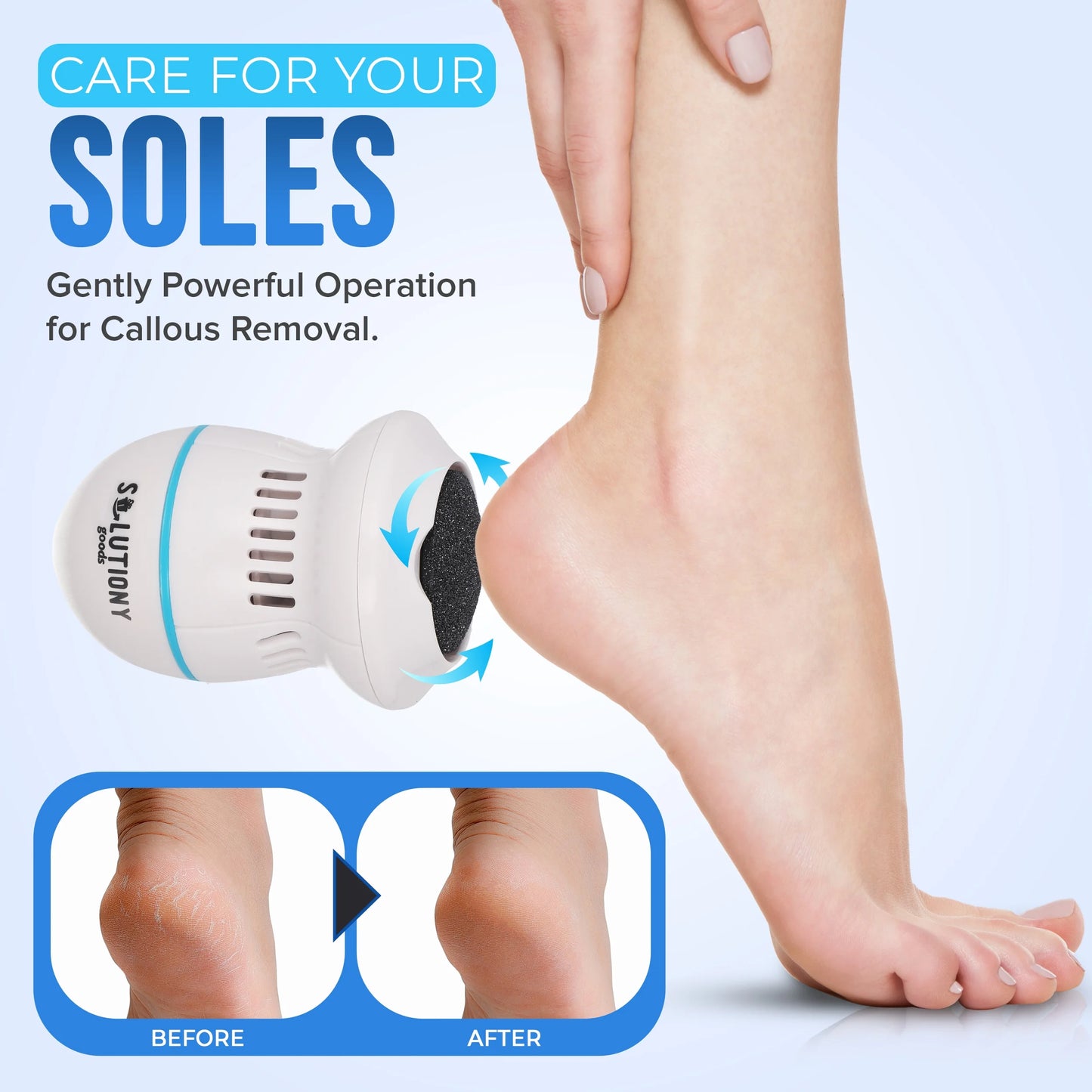 SmoothFeet™ Removedor de callos